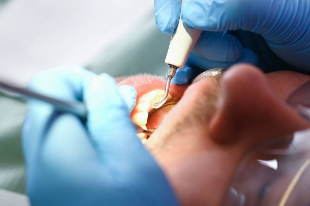 Best Emergency TMJ Treatment in Wakefield, MI