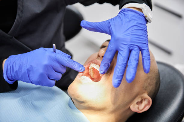 Best Emergency Tooth Extraction in Wakefield, MI